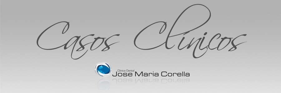 Casos Clínicos José María Corella