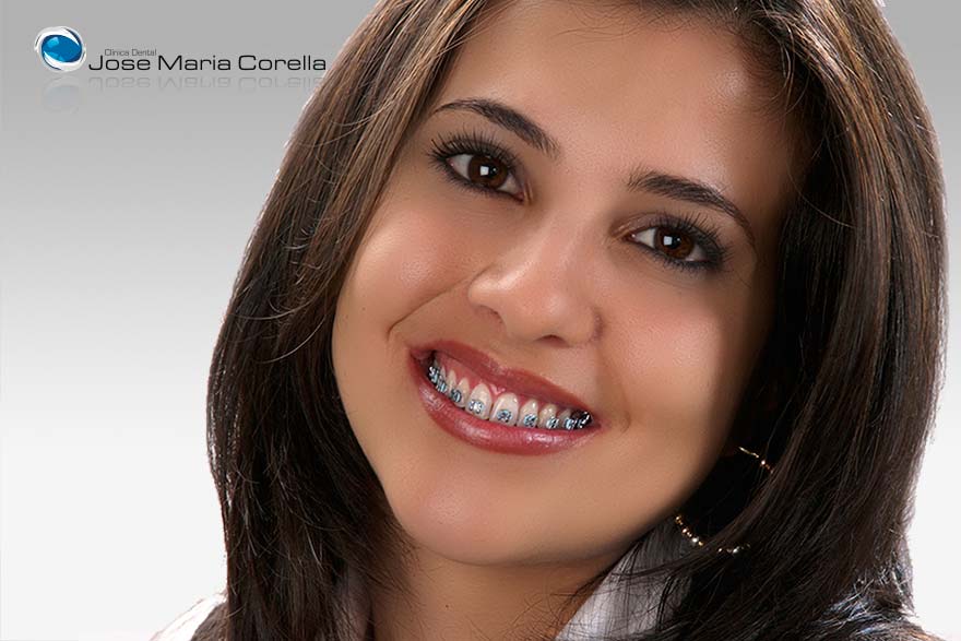 Ortodoncia Correctiva - Clínica Dental José María Corella