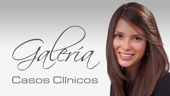Galería Casos Clínicos